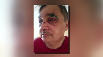 Инвалида жестоко избили в Петропавловске: горожане обвиняют полицейских в бездействии