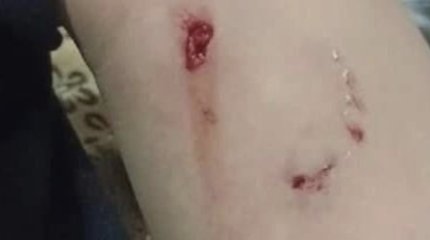 Домашний пёс искусал ребёнка в Усть-Каменогорске: реакция хозяина возмутила Казнет