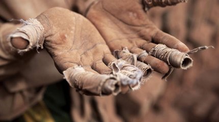 Душевнобольного жителя Семея увезли в рабство