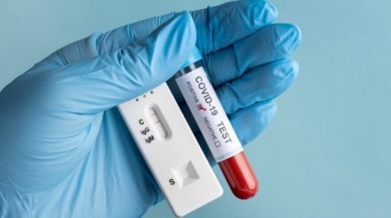 Елімізде 63 адамнан коронавирус инфекциясы анықталды