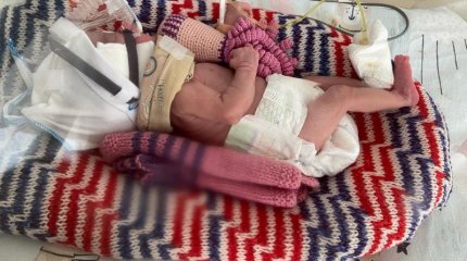 112 дней казахстанские врачи боролись за малышку весом 998 граммов