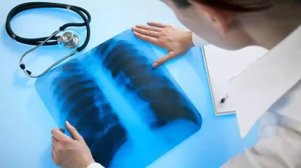 Қазақстанда туберкулезбен сырқаттану деңгейі 24 пайызға төмендеді