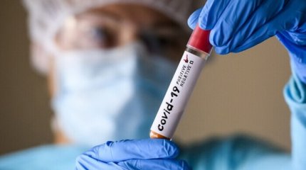 Бір күнде 76 адамнан коронавирус инфекциясы табылды