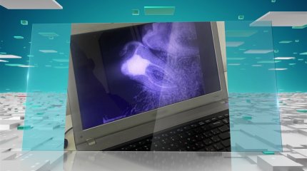 Астаналық тұрғынның тісінде дәрігердің екі құралы қалып қойған