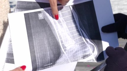 Карагандинский учитель год пытается доказать, что получила производственную травму