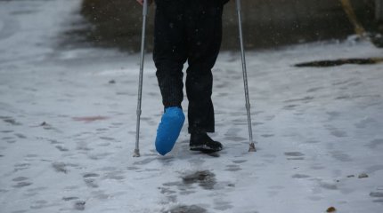 Антирекорд по ушибам и переломам: 515 карагандинцев попали в травмпункт за один день