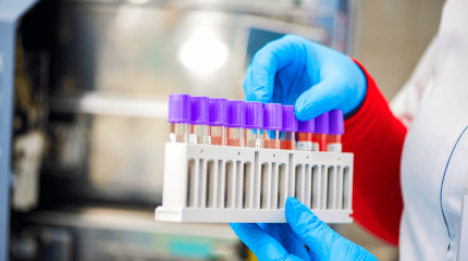 Өткен тәулікте 82 адамнан коронавирус анықталды