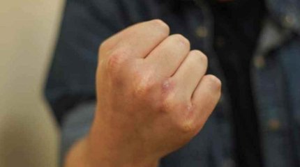 Ұлытау облысында кеніш қызметкерін сабаған күдіктілердің кім екені анықталды