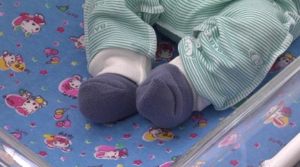 Павлодарда тік ішегі бітеу бала туды