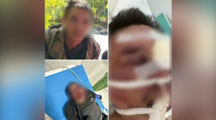 До состояния комы избили мужчину подростки в Алматинской области