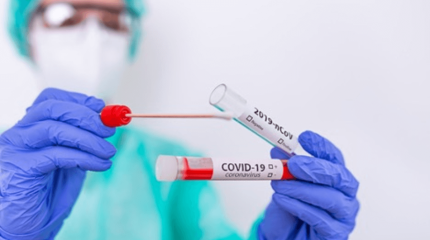 Өткен тәулікте елімізде 70 адамнан коронавирус инфекциясы анықталды