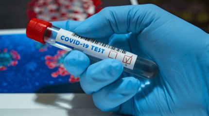 Өткен тәулікте елімізде 23 адамнан коронавирус анықталды