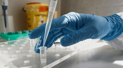 Әлемде тырысқақ ауруы кең тарауы мүмкін – ДДСҰ