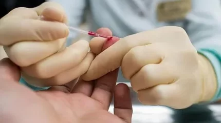 Жыл сайын 3 мыңнан астам қазақстандық АИТВ инфекциясын жұқтырады