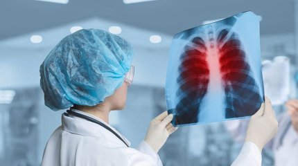 Шымкенттегі мектепте туберкулездің ашық түріне шалдыққан мұғалім жұмыс істеген