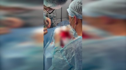 Шымкенттік дәрігерлер 10 жастағы баланың миынан бір уыс құрт алып шықты