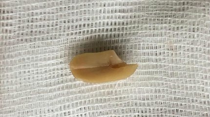 "Жержаңғақ-өте қауіпті"