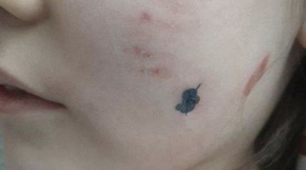 Стая бродячих собак напала на 8-летнюю девочку в Семее