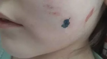 Семейде бұралқы иттер 8 жастағы қызды қапқан