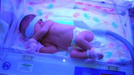 Алматыда дәрігерлер алғаш рет ауыр операция жасап, ана мен баланы аман алып қалды