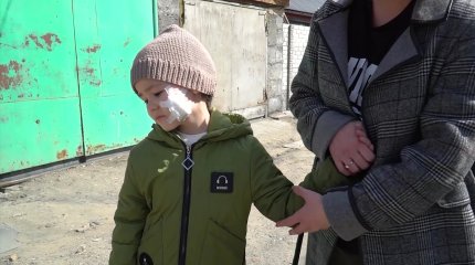 Нападение собак на девочку в Семее: появились подробности ЧП