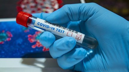 Өткен тәулікте Қазақстанда 28 адам коронавирус жұқтырды