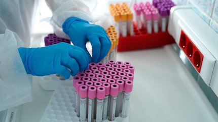 Елімізде өткен тәулікте 73 адамнан коронавирус анықталды – ДСМ