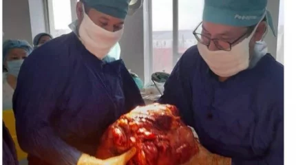 Атырауда дәрігерлергер науқастан 15 келілік ісік алды