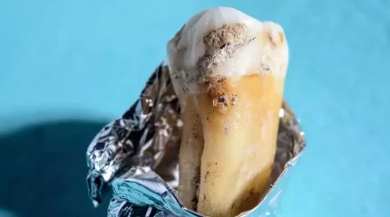 Ғалымдар неандерталь тісіндегі бактериядан жаңа антибиотик өндірмекші