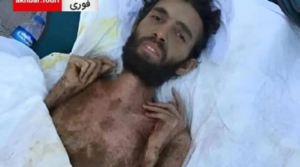 Сирийца достали живым из-под завалов спустя три месяца после землетрясения