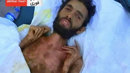 Три месяца под завалами в Сирии: журналисты заявили о фейке