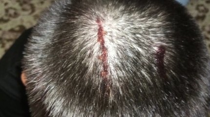 Подросток рассёк голову на спортплощадке в Костанае