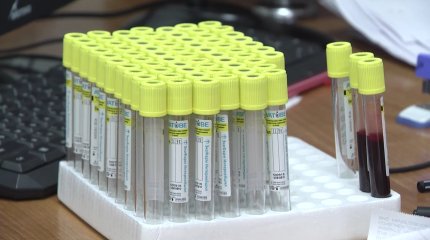 Заболеваемость ВИЧ в Казахстане выросла в два раза