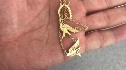 Қызылордада 2 жасар баланың асқазанынан алтын білезік пен сырға шықты