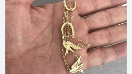 Золотой браслет и сережки извлекли из желудка маленького кызылординца