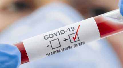 Коронавирус пандемиясы аяқталды