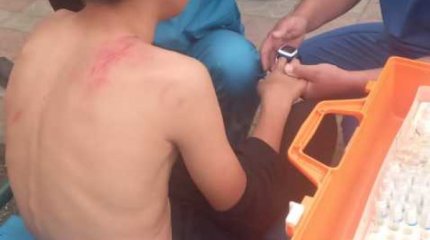 "Қашып үлгермеген". Қостанай облысында баланың үстіне ағаш құлаған