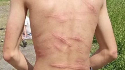 Карагандинского подростка поколотили палками за вымышленные домогательства к сверстнице