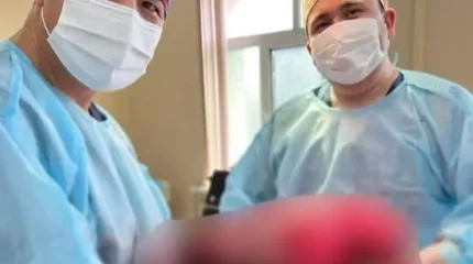 Төрт сағатқа созылды: Түркістандық дәрігерлер 9 келі ісікті алып тастады