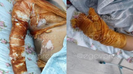 Үш жұмысшы күкірт қышқылына күйіп қалды