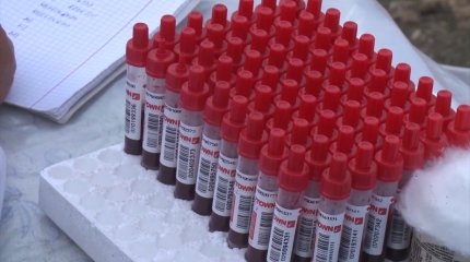 18 человек, из них трое детей, заразились бруцеллезом в Костанайской области