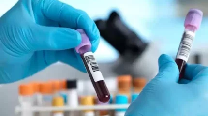 Британ ғалымдары қан талдауы арқылы қатерлі ісікті анықтаудың жаңа әдісін ойлап тапты