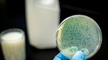 Қостанай облысында 21 адам бруцеллез жұқтырған, оның төртеуі бала