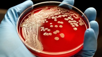 Четыре человека заразились сибирской язвой в двух районах Жамбылской области
