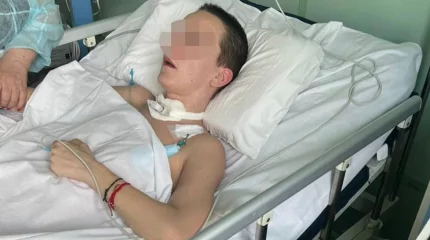 Әйел блефаропластика жасатамын деп бірнеше күннен бері есін жимаған