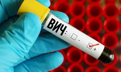 Алматыдағы ВИЧ жұқтыру жағдайы: Комиссия әлі жұмыс істеп жатыр