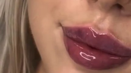 Инъекциями для увеличения губ и коррекции лица торгуют на известных в Казахстане маркетплейсах