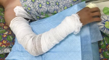 Ребенок попал в реанимацию после укуса змеи в Костанае