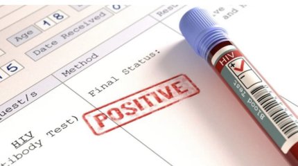 Пациентам занесли ВИЧ из-за несоблюдения медсестрами санитарных норм в Алматы