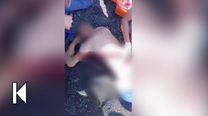 Алакөлге демалуға барған ер кісі аяғынан айырылды